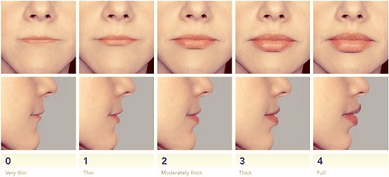 Uitgelezene Vollere lippen? Filler behandelingen met hyaluronzuur QX-86